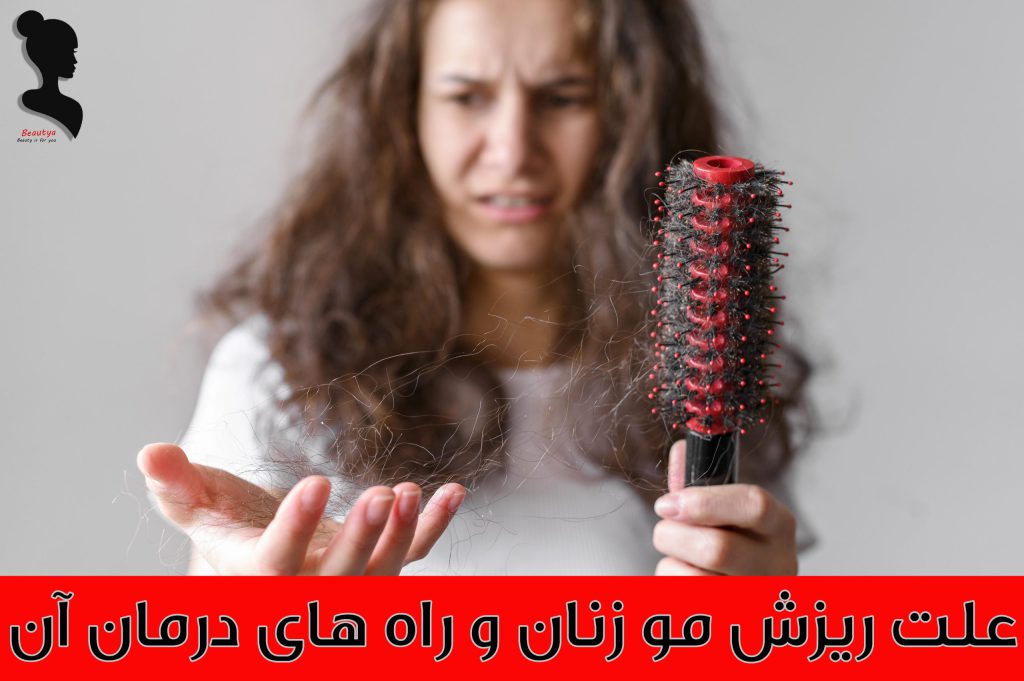 دلایل ریزش مو در زنان و راه های جلوگیری از آن1