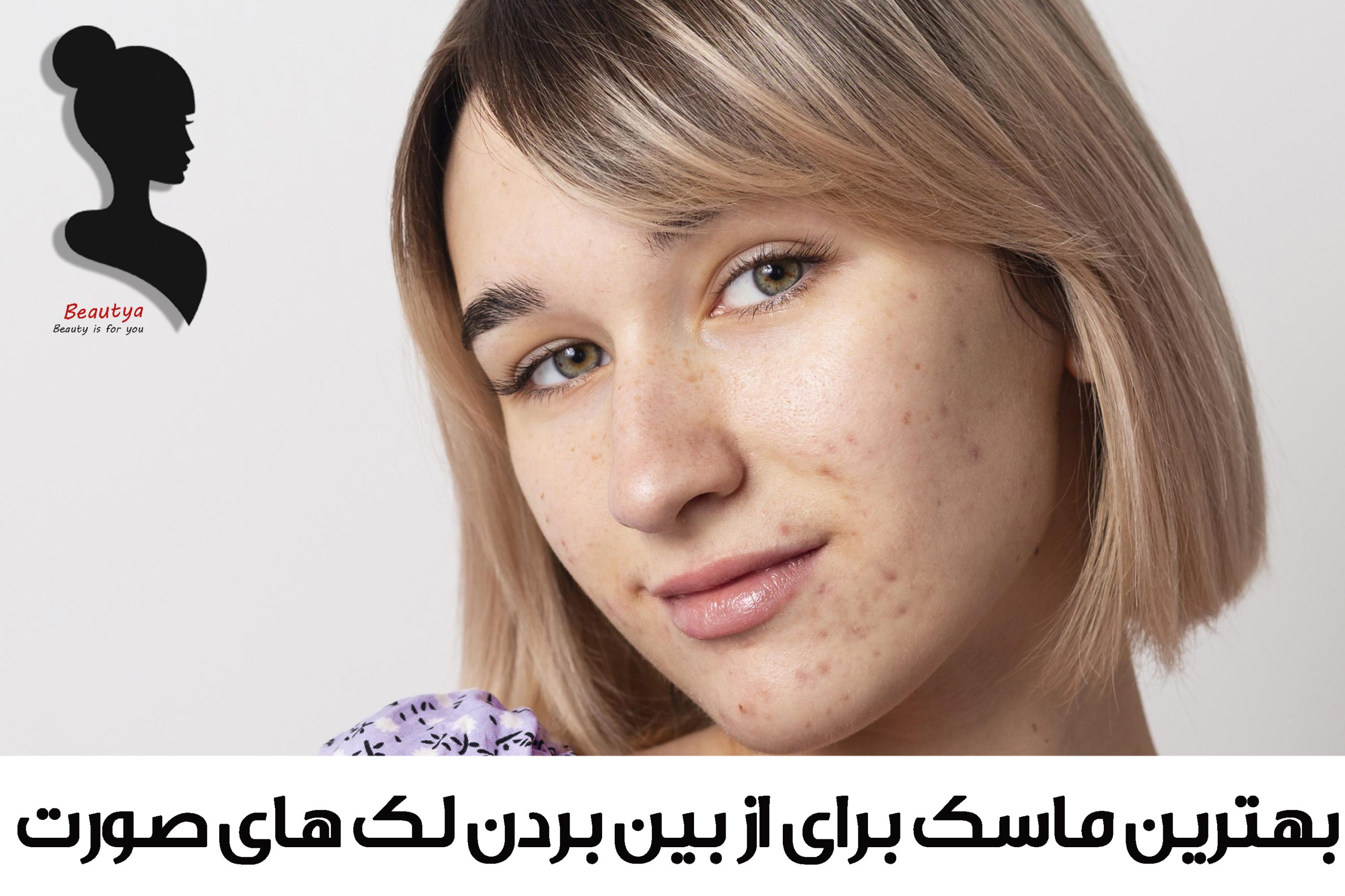 بهترین ماسک های صورت برای لک