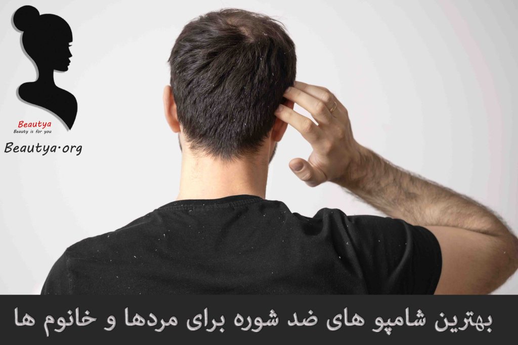 بهترین شامپوهای ضد شوره