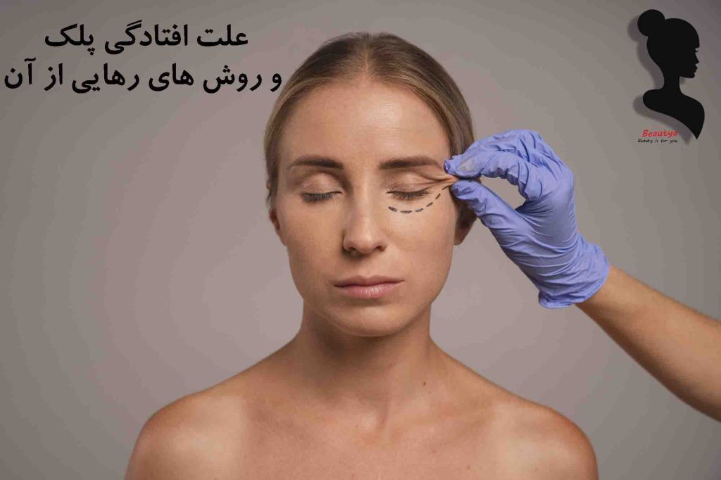 علت افتادگی پلک