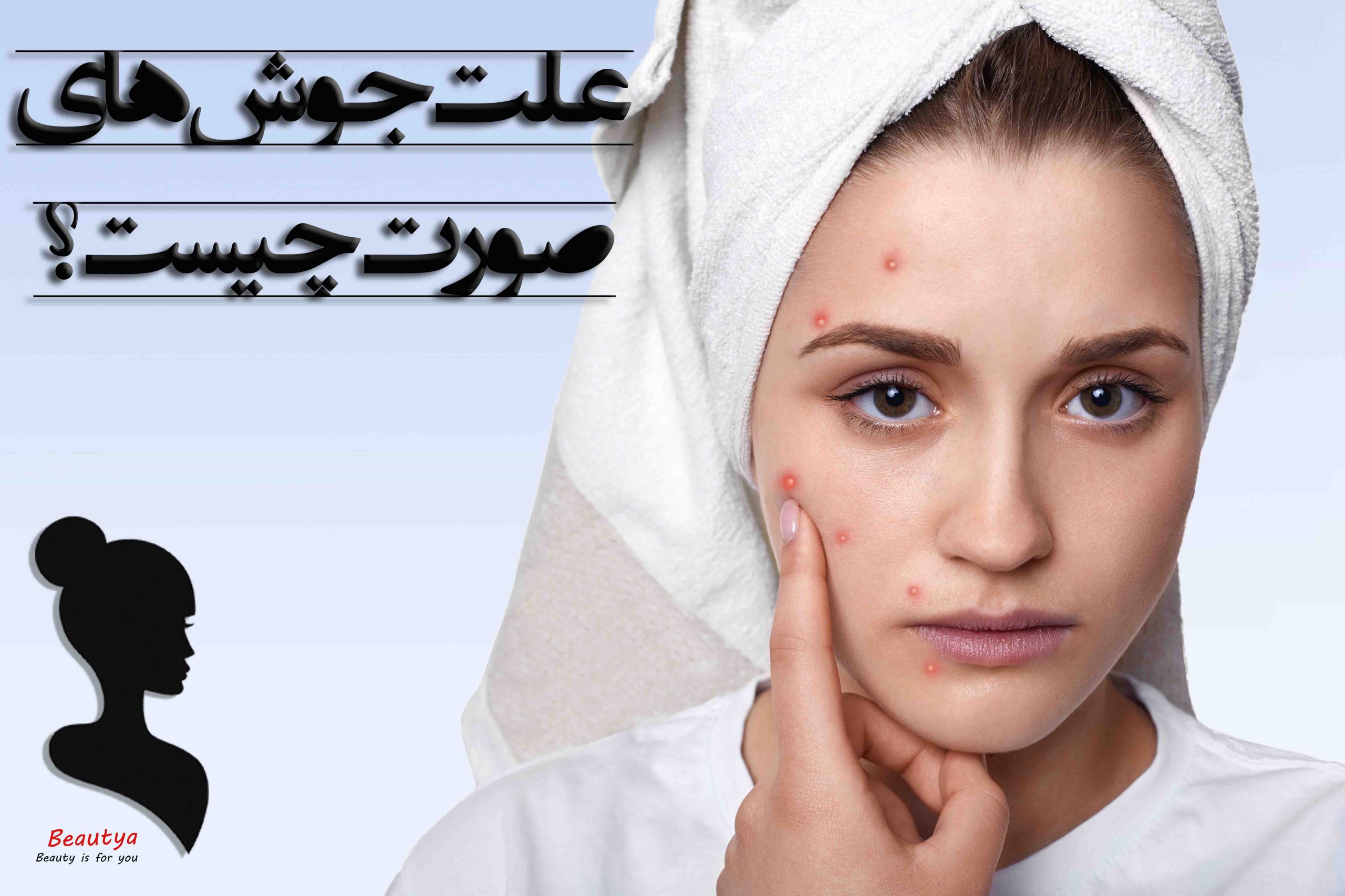علت جوش های بدن1