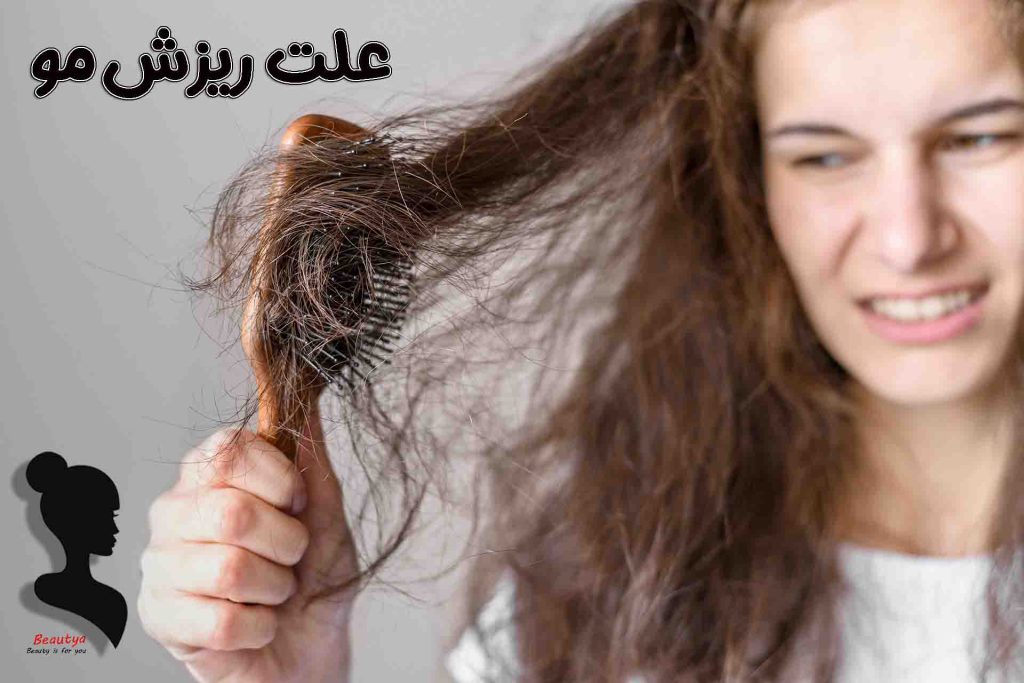 انواع ریزش مو