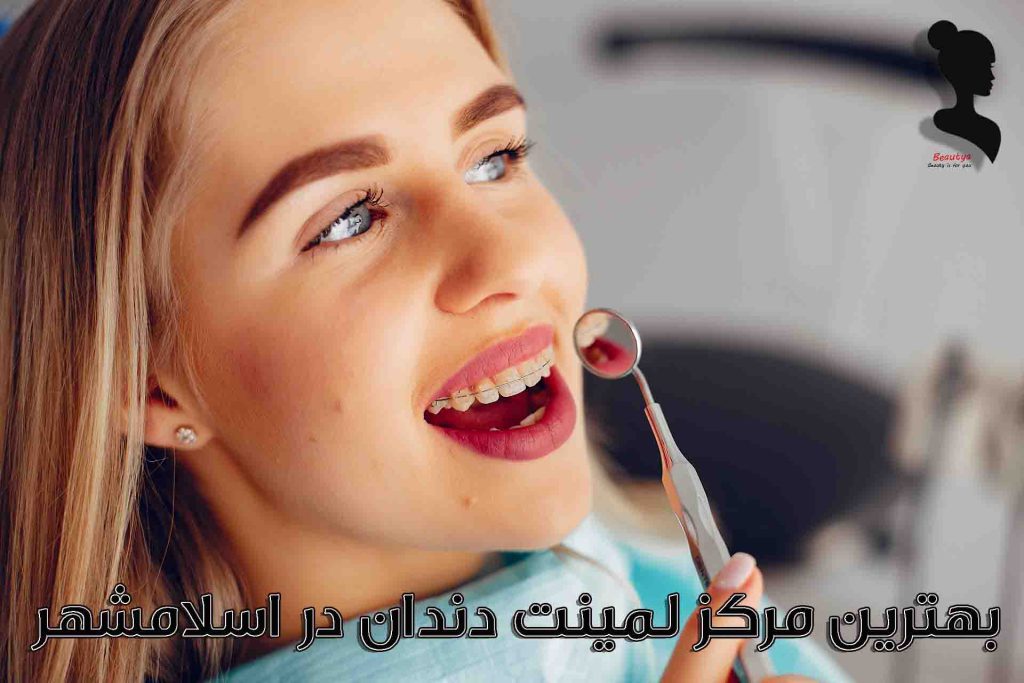بهترین مراکز لمینت دندان در اسلامشهر1