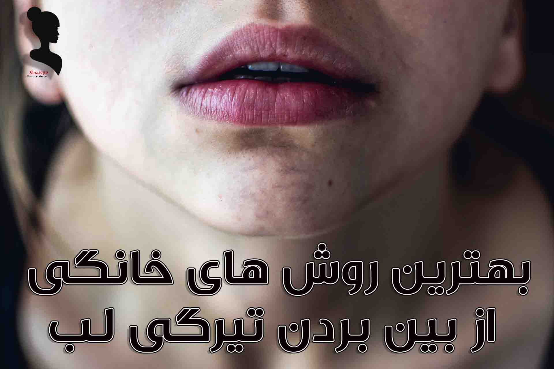 بهترین روش های خانگی از بین بردن تیرگی لب