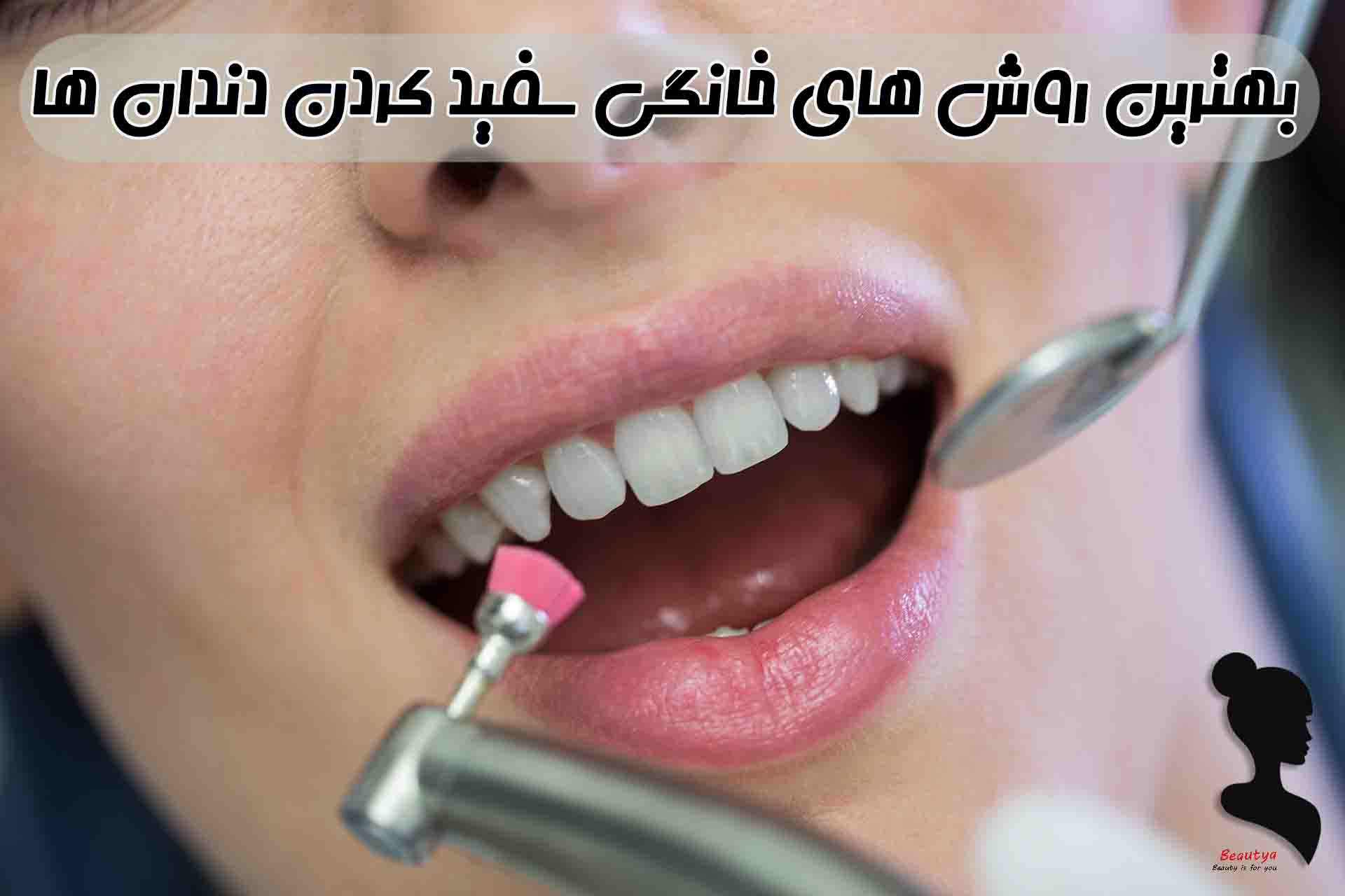 12 روش خانگی سفید کردن دندان ها1