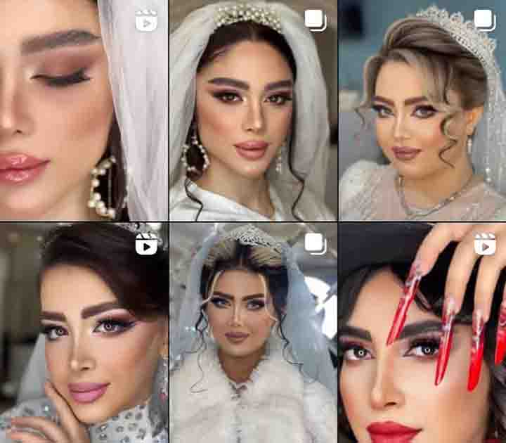 نمونه کار آنسه