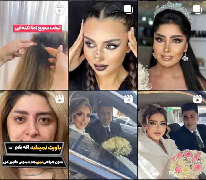 نمونه کار آنسه