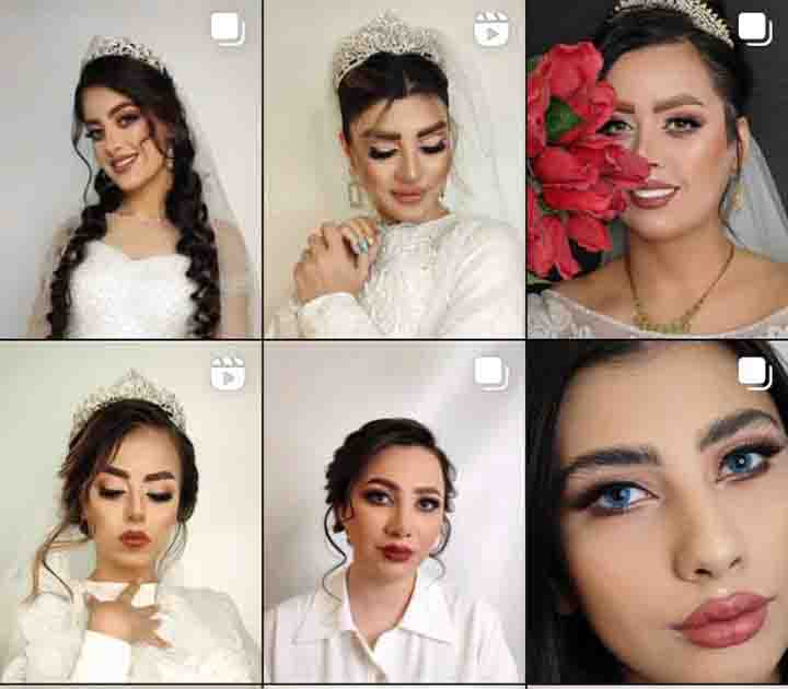نمونه کار احیای مو نازنین جباری